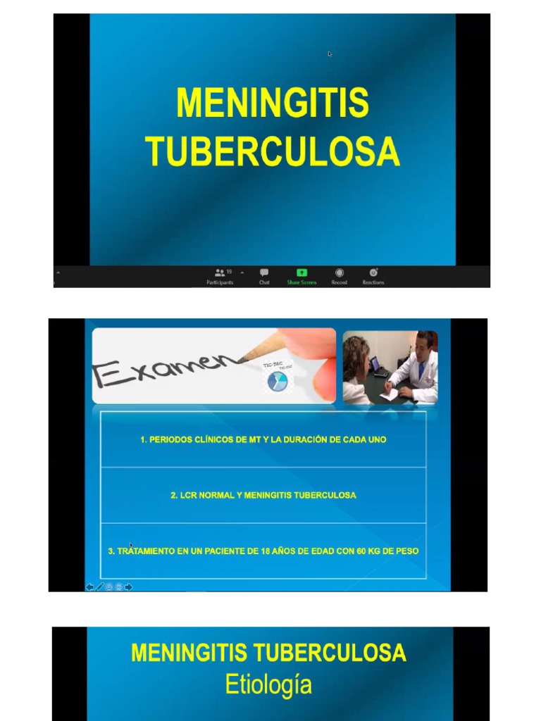 Meningitis Tuberculosa PDF