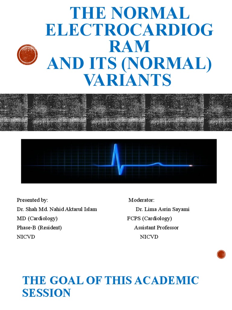 ECG Presentation | Download Free PDF | Electrocardiography | Cardiac ...