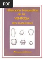 Utilización Terapéutica de la Ventosa