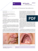 Austin: An Unusual Manifestation of Cutaneous Sarcoidosis in The Oral Cavity