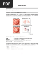 Clasificación Bethesda en Citología Cervical | PDF | Cáncer ...
