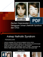 Askep Sindrom Nefrotik