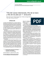 Tiña Del Cuerpo Diseminada, Tiña de La Mano y Tiña de Los Pies Por