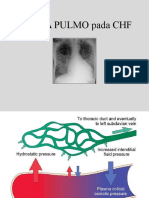 Edema Pulmo Pada CHF