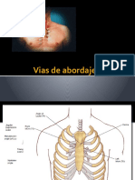 Vias de Abordaje Toracico