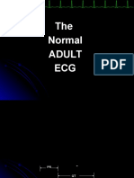 The Normal Adult ECG