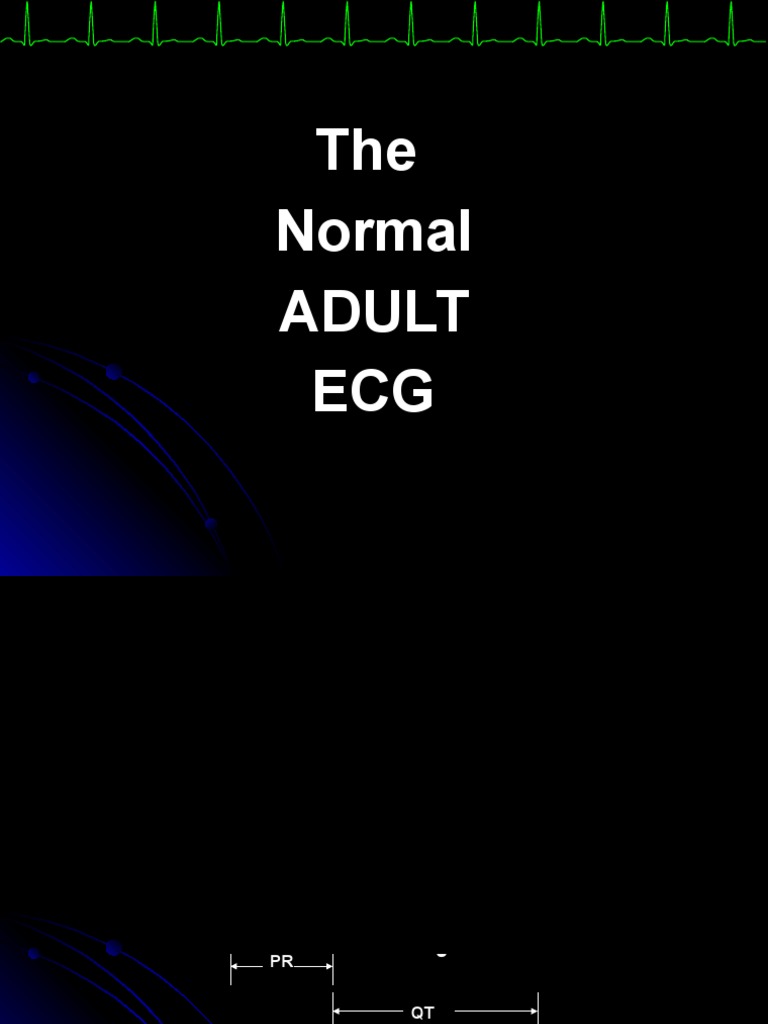 Adult ECG Interpretation Guide | PDF | Electrocardiography ...