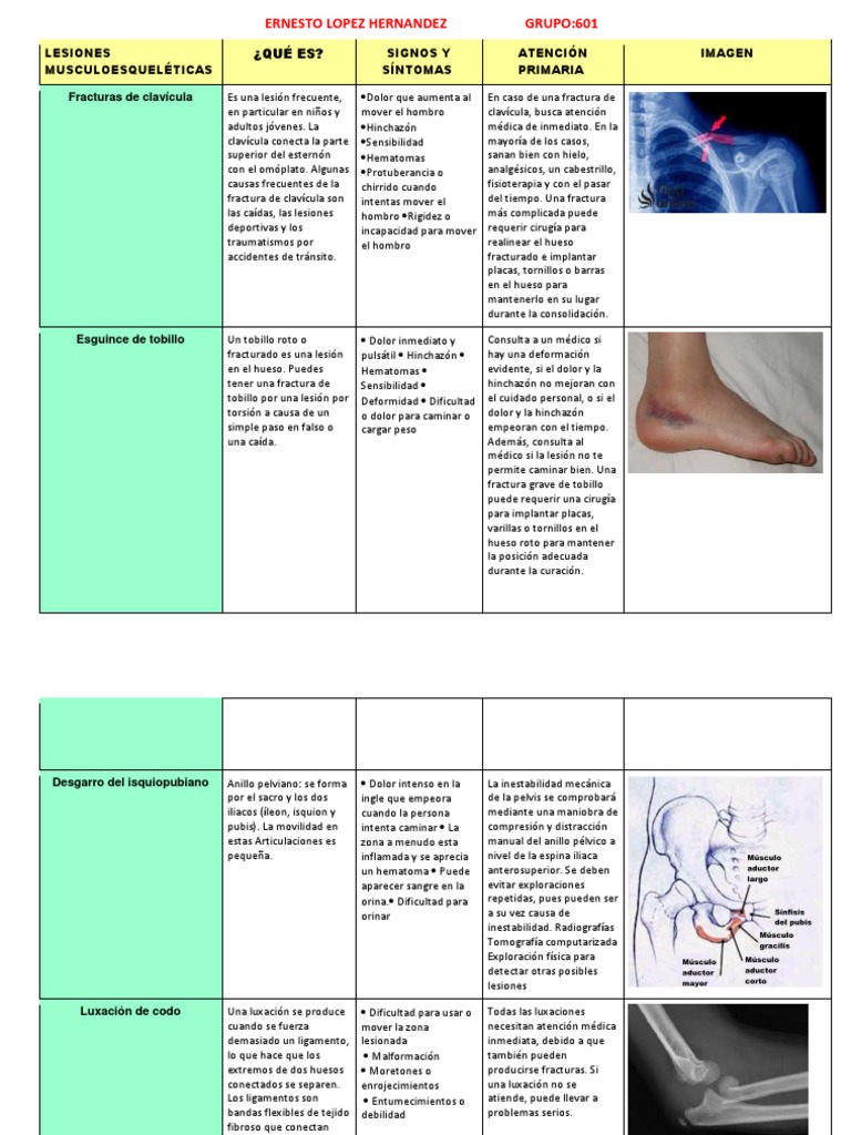 Lesiones Musculoesqueléticas | PDF | Hombro | Pelvis