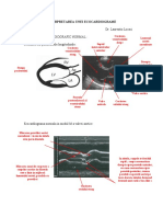 Interpretarea Unei Ecocardiograme