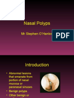 Nasal Polyps: MR Stephen O'Hanlon