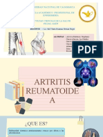 Artritis Reumatoidea-Teoria