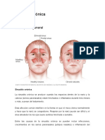 Sinusitis crónica