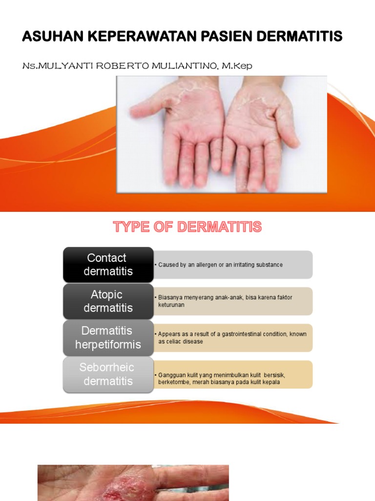 Asuhan Keperawatan Pasien Dermatitis Present | PDF | Dermatitis