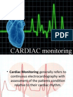 Cardiac Monitoring