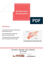 De Quervain's Tendinosis