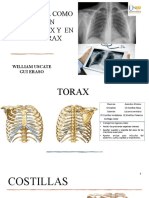 Reja Costal Laboratorio-Diapositivas