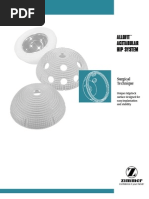 AllofitST Surgical Tech | PDF | Screw | Nature
