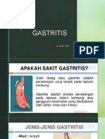 GASTRITIS