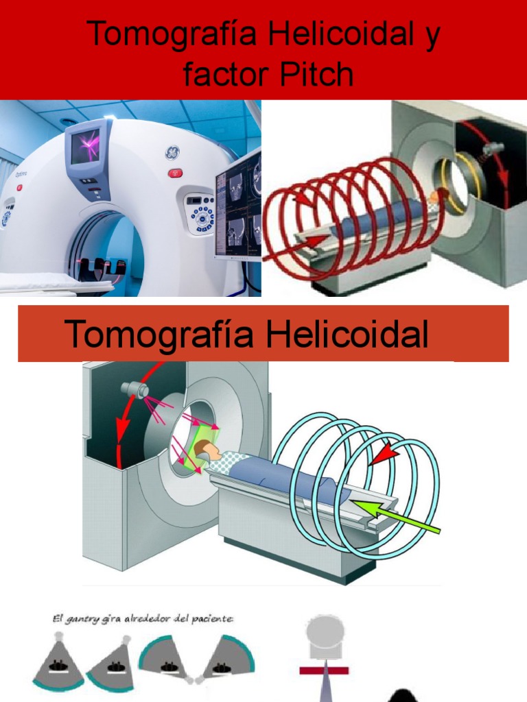Pitch y TC Helicoidal PDF Ct Scan