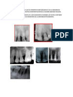 Tarea de Enfermded Periodontal