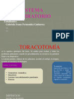 TORACOTOMIA