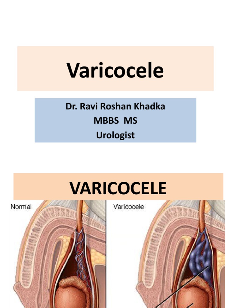 Scrotal Disease 2 PDF Genitourinary System Diseases Testicle