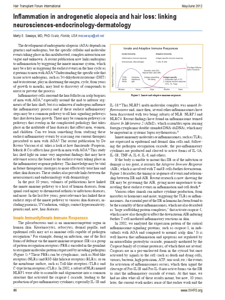 In Ammation in Alopecia and Hair Loss Linking