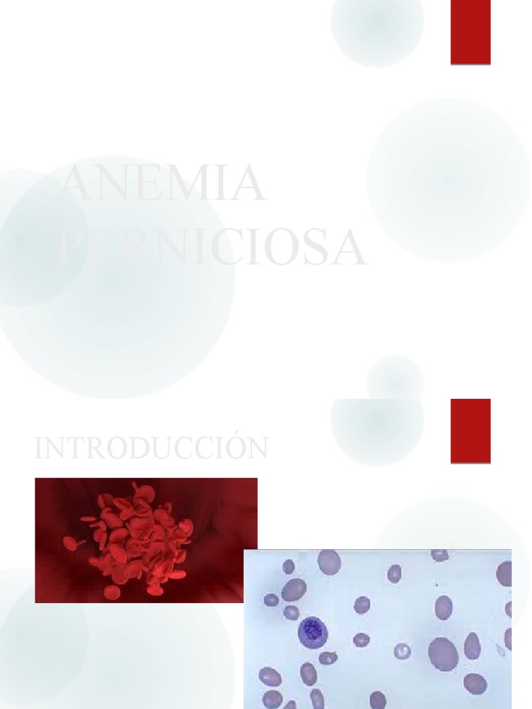 Anemia Perniciosa PDF Anemia Vitamina B12