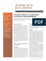 Abordaje de La Úlcera Péptica: Estenosis Pilórica y Perforación en La Úlcera Gastroduodenal