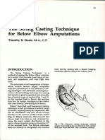 The String Casting Technique For Below Elbow Amputations: Timothy B. Staats, M.A., C.P