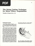 The String Casting Technique For Below Elbow Amputations: Timothy B. Staats, M.A., C.P