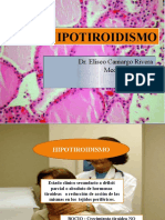 HIPOTIROIDISMO1