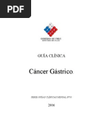 cancer gastrico
