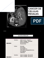 10 cancer renal