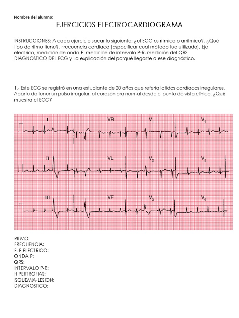 Casos Clinicos Ecg | PDF | Electrocardiografia | Infarto de miocardio
