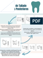 Protocolo de Tallado en Dientes Posteriores