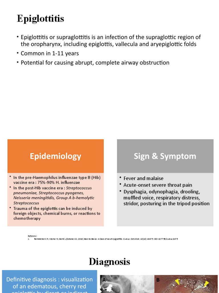 Epiglottitis and Laryngitis PDF Immunology Respiratory Diseases