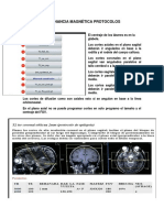 Resonancia Magnética