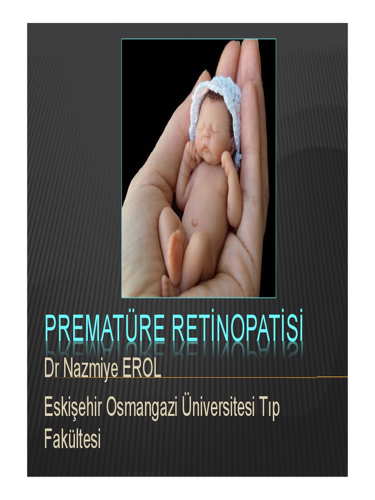 Prematüre Retinopati PDF