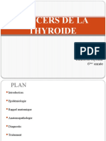 Cancers de La Thyroide