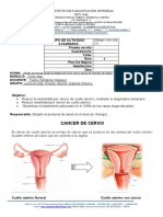 Guia de Cancer de Cervix