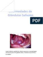 Enfermedades Glandulas Salivales