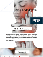 Caso Clínico Endodoncia