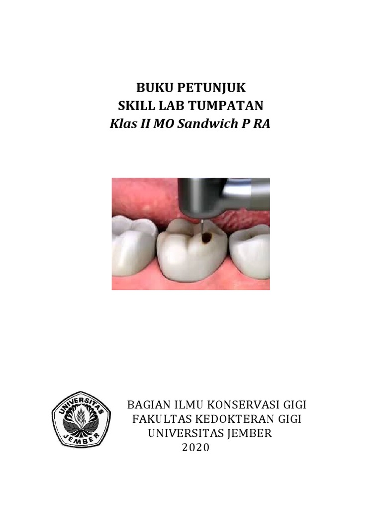 Panduan Tumpatan Sandwich Kelas II | PDF | Griya & Taman