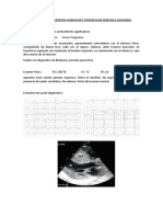 Mehu130 - U1 - T13 - Caso Clinico Hipertrofia Auricular y Ventricular