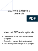 EEG y Epilepsia