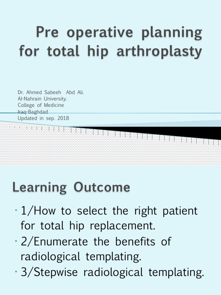 Preoperative Planning for Hip Arthroplasty | PDF | Hip | Pelvis