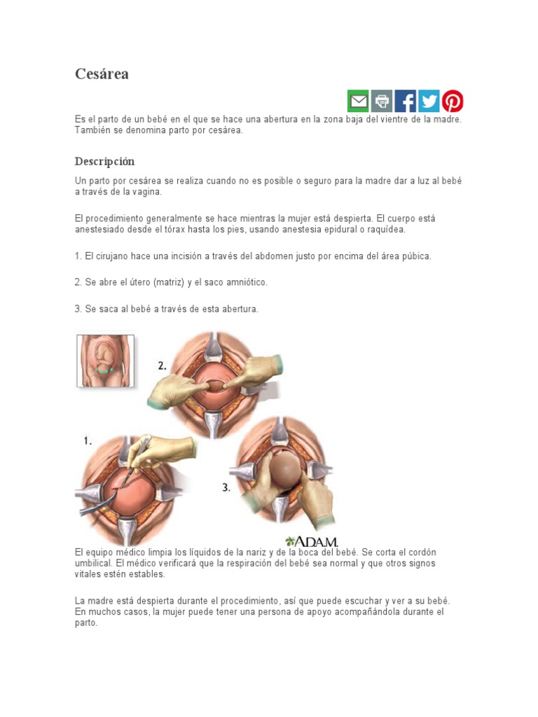 Ces Área | PDF | Parto | Seccion de cesárea