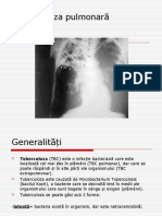 Tuberculoza Pulmonară
