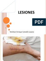 Lesiones